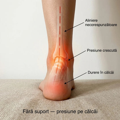 Presiune și durere în călcâi fără suport